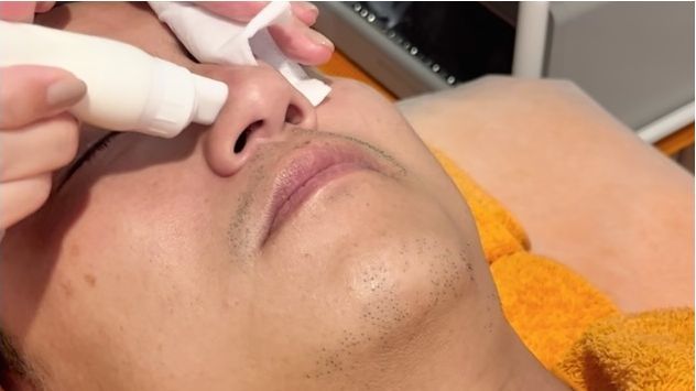 ハンドフェイシャル